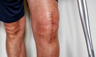 cicatrice opération du genou
