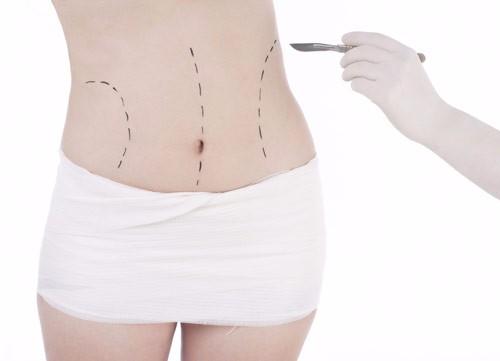 Operation et chirurgie de la hanche Operation et chirurgie de la hanche